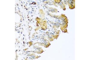 Immunohistochemistry of paraffin-embedded mouse lung using Vitronectin antibody (ABIN3022357, ABIN3022358, ABIN3022359 and ABIN6218758) at dilution of 1:100 (40x lens). (Vitronectin anticorps  (AA 364-478))
