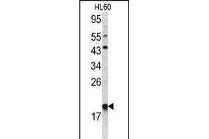 Western blot analysis of ARPC3 antibody (C-term) (ABIN390532 and ABIN2840878) in HL60 cell line lysates(35 μg/lane). (ARPC3 anticorps  (C-Term))