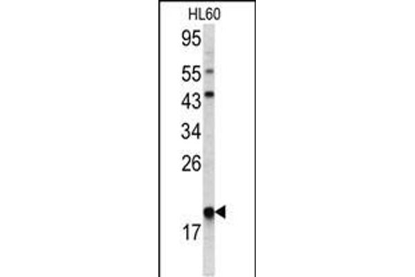 ARPC3 anticorps  (C-Term)
