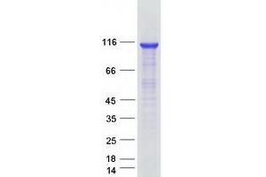 Validation with Western Blot