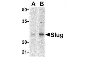 Western blot analysis of Slug in human kidney cell lysate with this product at in (A) 1 and (B) 2 μg/ml. (SLUG anticorps  (Center))