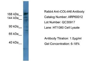 WB Suggested Anti-COL4A6  Antibody Titration: 0. (COL4a6 anticorps  (Middle Region))