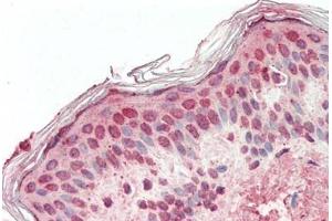 Human, Skin: Formalin-Fixed Paraffin-Embedded (FFPE)