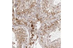 Immunohistochemical staining of human testis with TCTEX1D1 polyclonal antibody  shows cytoplasmic positivity in leydig and Sertoli cells at 1:500-1:1000 dilution.