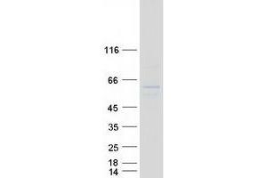 Validation with Western Blot