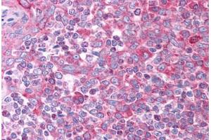 Image no. 2 for anti-Chemokine (C-C Motif) Ligand 7 (CCL7) (AA 30-79) antibody (ABIN6736363)