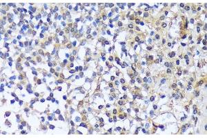 Immunohistochemistry of paraffin-embedded Human tonsil using A1CF Polyclonal Antibody at dilution of 1:100 (40x lens). (A1CF anticorps)