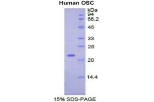SDS-PAGE analysis of Human Oxidosqualene Cyclase Protein. (LSS Protéine)