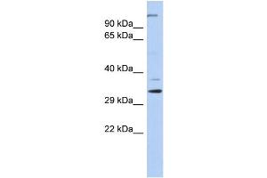WB Suggested Anti-ARPC2 Antibody Titration: 0. (ARPC2 anticorps  (N-Term))