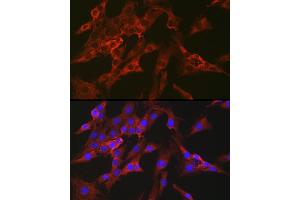 Immunofluorescence analysis of C6 cells using FBP1 Rabbit pAb (ABIN6130385, ABIN6140501, ABIN6140502 and ABIN6221054) at dilution of 1:100 (40x lens). (FBP1 anticorps  (AA 1-338))