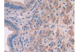 DAB staining on IHC-P; Samples: Mouse Uterus Tissue (MYLK2 anticorps  (AA 330-548))