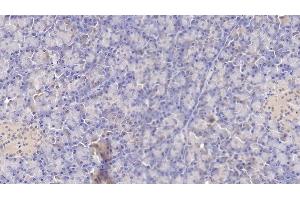 Detection of TF in Human Pancreas Tissue using Monoclonal Antibody to Tissue Factor (TF) (Tissue factor anticorps  (AA 34-251))