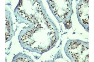 Image no. 5 for anti-Nucleolin (NCL) antibody (ABIN6166144)