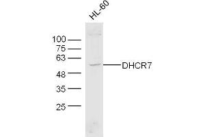 Human HL-60 cell lysates probed with Anti-DHCR7 Polyclonal Antibody, Unconjugated  at 1:300 overnight at 4˚C. (DHCR7 anticorps  (AA 351-450))