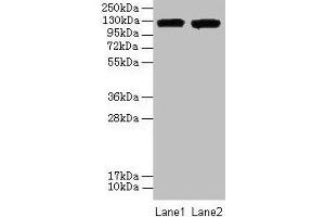 Western blot All lanes: ITGAL antibody at 8 μg/mL Lane 1: A549 whole cell lysate Lane 2: HepG2 whole cell lysate Secondary Goat polyclonal to rabbit IgG at 1/10000 dilution Predicted band size: 129, 135, 120 kDa Observed band size: 129 kDa (ITGAL anticorps  (AA 201-500))