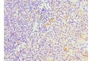 Immunohistochemistry of paraffin-embedded human tonsil tissue using ABIN7169354 at dilution of 1:100 (SERPINH1 anticorps  (AA 139-418))