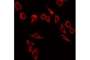 ABIN6272316 staining HeLa by IF/ICC. (HABP2 anticorps  (Internal Region))