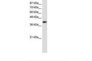 Image no. 1 for anti-Distal-Less Homeobox 3 (DLX3) (C-Term) antibody (ABIN202161) (DLX3 anticorps  (C-Term))