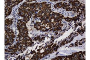 Image no. 5 for anti-Asialoglycoprotein Receptor 2 (ASGR2) antibody (ABIN1496744)