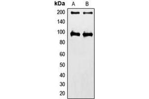 Western blot analysis of IGF1 Receptor expression in HeLa (A), MCF7 (B) whole cell lysates. (IGF1R anticorps  (C-Term))