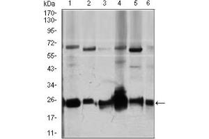 Western Blotting (WB) image for anti-rho GDP Dissociation Inhibitor (GDI) alpha (ARHGDIA) (AA 1-204) antibody (ABIN1844919)