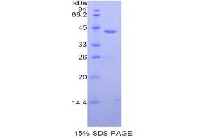 SDS-PAGE analysis of Human HIST1H2AB Protein. (HIST1H2AB Protéine)