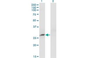Western Blot analysis of CRYBB3 expression in transfected 293T cell line by CRYBB3 monoclonal antibody (M01), clone 4H6.