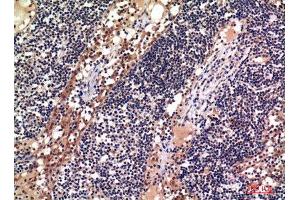 Immunohistochemistry (IHC) analysis of paraffin-embedded Human Lymph, antibody was diluted at 1:100. (ADAM10 anticorps)