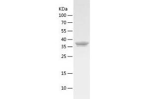 Western Blotting (WB) image for Aminolevulinate Dehydratase (ALAD) (AA 1-354) protein (His tag) (ABIN7121814)