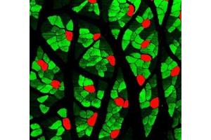 Immunofluorescent analysis of paraformaldehyde-fixed rat skeletal muscle using MYH1 (, red ) and MYH7 (ABIN7075623, green ) at dilution of 1: 1000 (Slow Skeletal Myosin Heavy Chain anticorps)