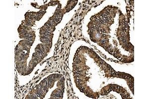 IHC analysis of Proteasome 20S Beta 7/PSMB7 using anti-Proteasome 20S Beta 7/PSMB7 antibody (ABIN7600256).