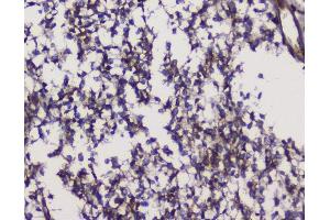 IHC analysis of GRIK1 using anti-GRIK1 antibody (ABIN3042430). (GRIK1 anticorps  (AA 271-450))