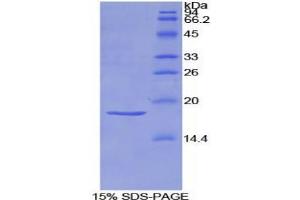 SDS-PAGE analysis of Rat Semaphorin 3A Protein. (SEMA3A Protéine)