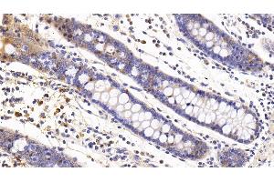 Detection of IL6 in Human Colon Tissue using Monoclonal Antibody to Interleukin 6 (IL6)