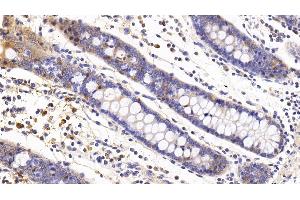 Detection of IL6 in Human Colon Tissue using Monoclonal Antibody to Interleukin 6 (IL6) (IL-6 anticorps  (AA 29-212))