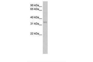 Image no. 1 for anti-Carbonic Anhydrase IV (CA4) (AA 131-180) antibody (ABIN204967) (CA4 anticorps  (AA 131-180))