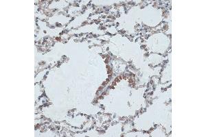 Immunohistochemistry of paraffin-embedded mouse lung using PMEP antibody (6555) at dilution of 1:100 (40x lens). (PMEPA1 anticorps  (AA 173-252))