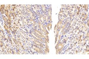 Detection of PCK1 in Mouse Stomach Tissue using Polyclonal Antibody to Phosphoenolpyruvate Carboxykinase 1, Soluble (PCK1)