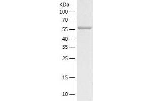 Western Blotting (WB) image for Cadherin 11 (CDH11) (AA 54-617) protein (His tag) (ABIN7122070)