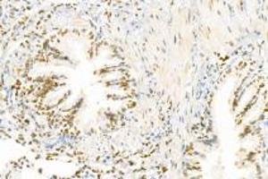 Immunohistochemistry analysis of paraffin-embedded rat lung using,PNN (ABIN7075083) at dilution of 1: 1200