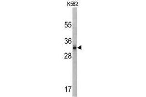 Image no. 1 for anti-Calcium Channel, Voltage-Dependent, gamma Subunit 5 (CACNG5) (C-Term) antibody (ABIN452794) (CACNG5 anticorps  (C-Term))