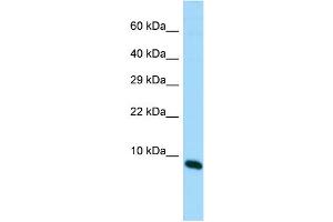 Host: Rabbit Target Name: MIR22HG Sample Type: Fetal Brain lysates Antibody Dilution: 1. (MIR22HG anticorps  (C-Term))