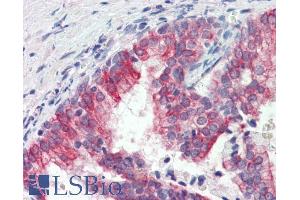 ABIN5539753 (3µg/ml) staining of paraffin embedded Human Prostate.