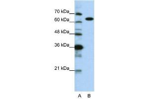 WB Suggested Anti-KARS  Antibody Titration: 0. (KARS anticorps  (C-Term))