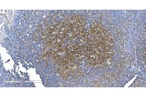 IHC analysis of GCHFR using anti-GCHFR antibody (ABIN7600511).