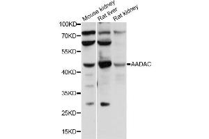 Western blot analysis of extracts of various cell lines, using AADAC antibody.