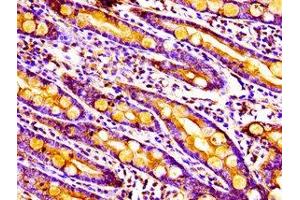 Immunohistochemistry of paraffin-embedded human small intestine tissue using ABIN7142326 at dilution of 1:100 (MPST anticorps  (AA 102-208))