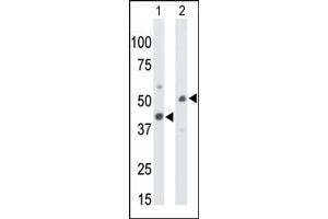 The anti-CKMT1 Pab (ABIN391091 and ABIN2841231) is used in Western blot to detect CKMT1 in mouse colon tissue lysate (Lane 1) and ZR-75-1 cell lysate (Lane 2).