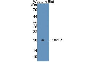Detection of Recombinant ECRG4, Human using Polyclonal Antibody to Esophageal Cancer Related Gene 4 (ECRG4)
