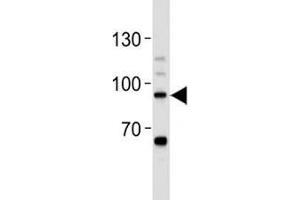 STAT-3 antibody western blot analysis in Daudi lysate.
